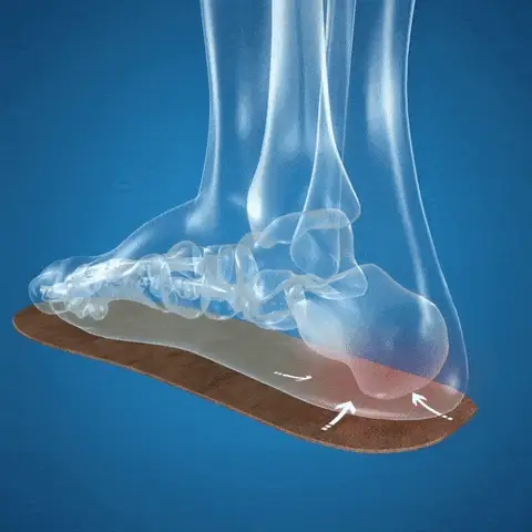 Diagram showing foot decompression