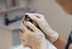 Dental Procedures