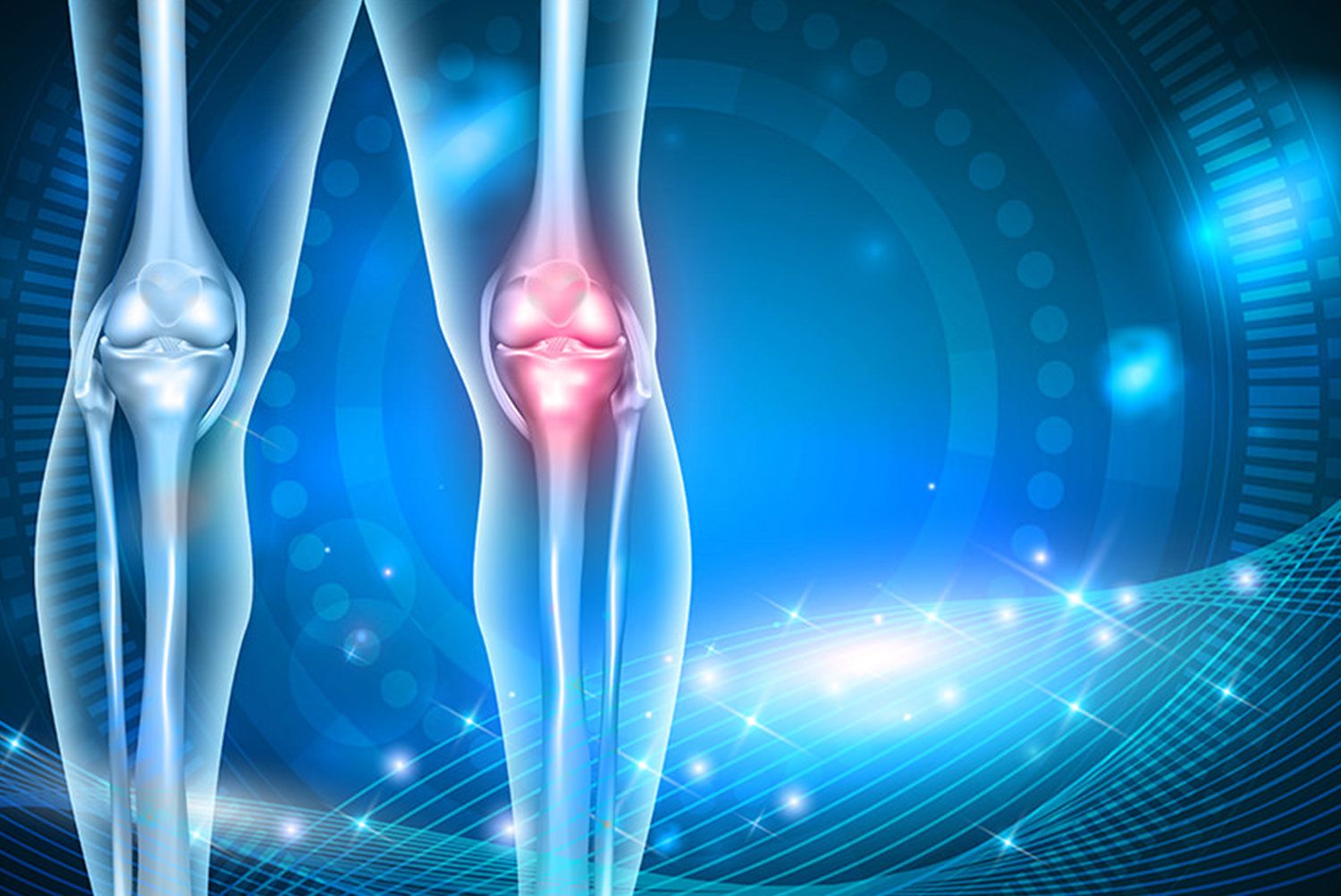 Detailed orthopaedic view of a knee joint